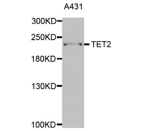 Western blot - TET2 antibody from Signalway Antibody (38680) - Antibodies.com