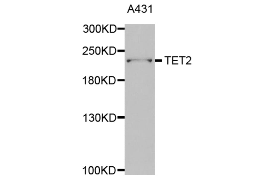 Western blot - TET2 antibody from Signalway Antibody (38680) - Antibodies.com