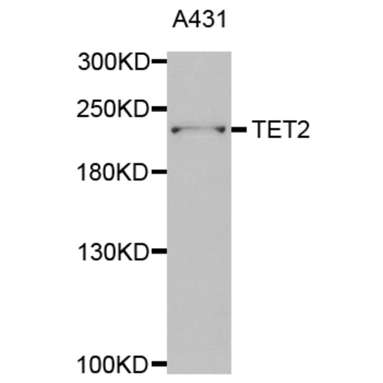 Western blot - TET2 antibody from Signalway Antibody (38680) - Antibodies.com
