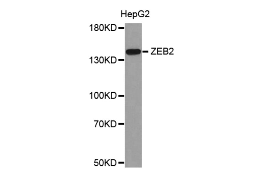 Western blot - ZEB2 antibody from Signalway Antibody (38682) - Antibodies.com