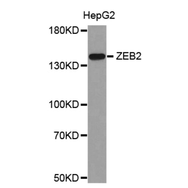 Western blot - ZEB2 antibody from Signalway Antibody (38682) - Antibodies.com