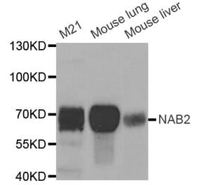 Western blot - NAB2 antibody from Signalway Antibody (38694) - Antibodies.com