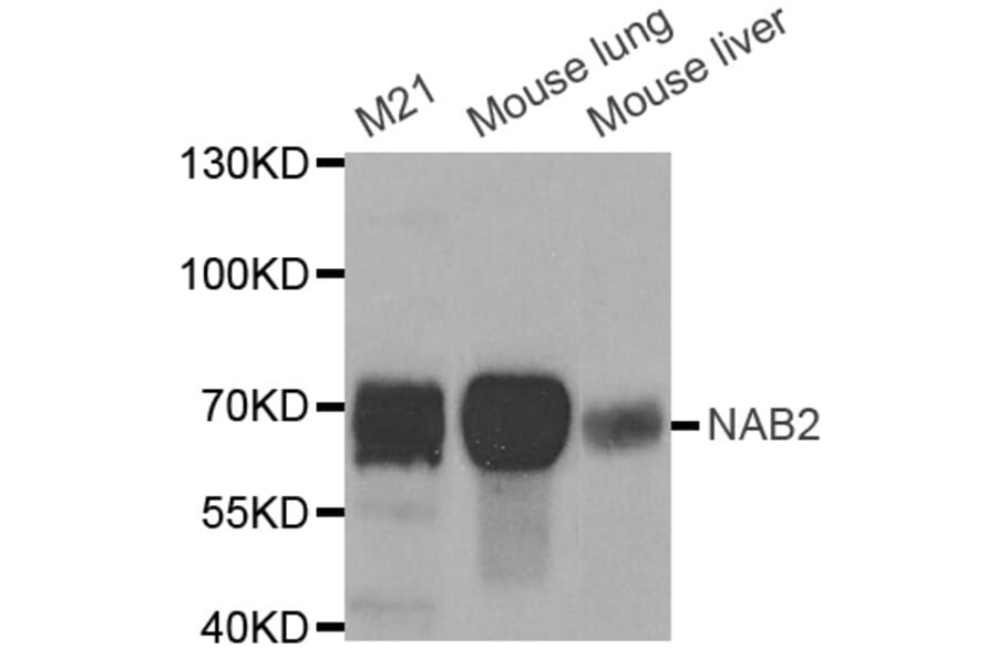 Western blot - NAB2 antibody from Signalway Antibody (38694) - Antibodies.com
