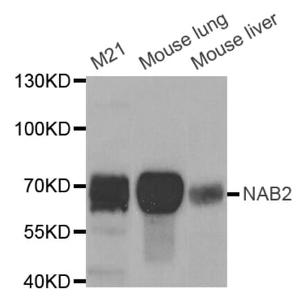 Western blot - NAB2 antibody from Signalway Antibody (38694) - Antibodies.com