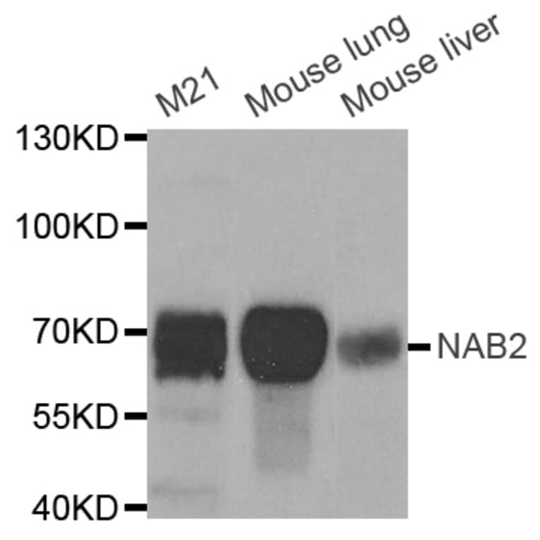 Western blot - NAB2 antibody from Signalway Antibody (38694) - Antibodies.com