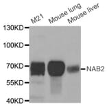 Western blot - NAB2 antibody from Signalway Antibody (38694) - Antibodies.com