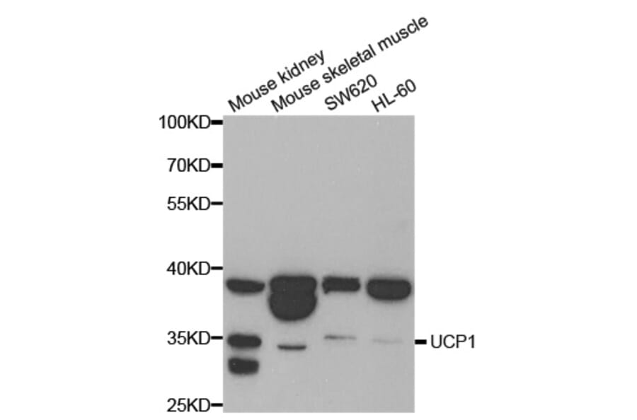 Western blot - UCP1 antibody from Signalway Antibody (38698) - Antibodies.com