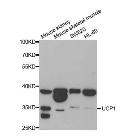 Western blot - UCP1 antibody from Signalway Antibody (38698) - Antibodies.com
