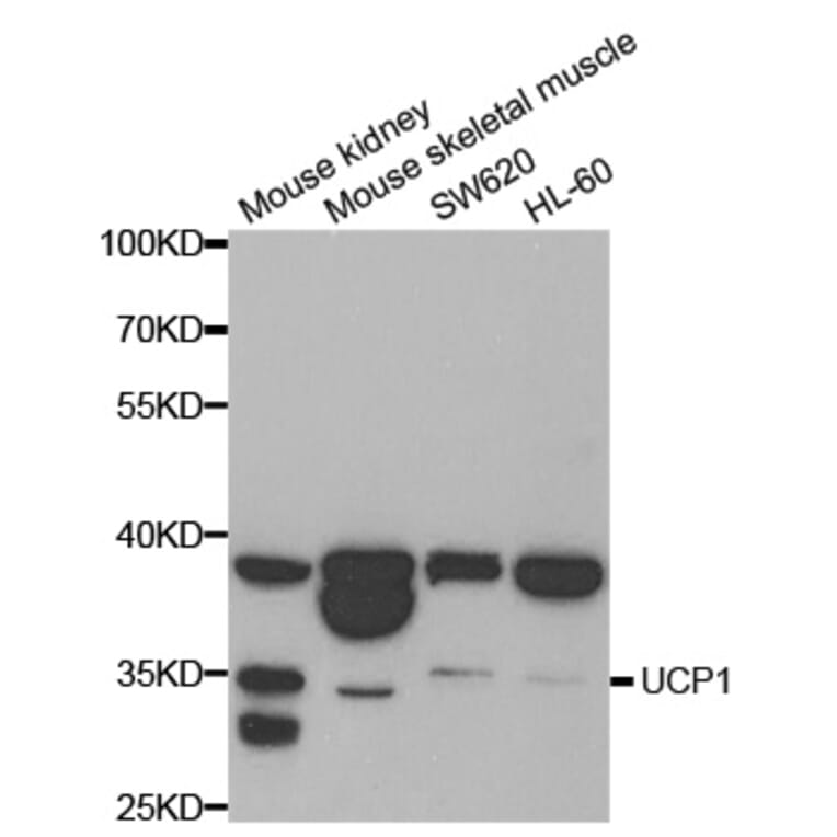 Western blot - UCP1 antibody from Signalway Antibody (38698) - Antibodies.com