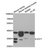 Western blot - UCP1 antibody from Signalway Antibody (38698) - Antibodies.com