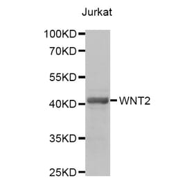 Western blot - WNT2 antibody from Signalway Antibody (38699) - Antibodies.com