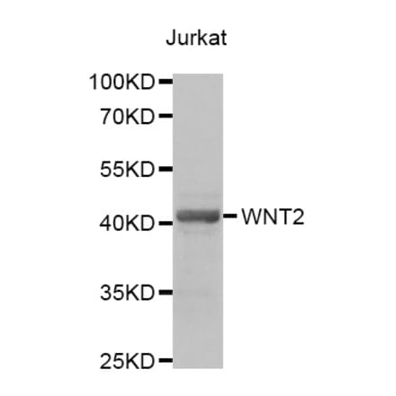 Western blot - WNT2 antibody from Signalway Antibody (38699) - Antibodies.com