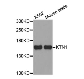 Western blot - KTN1 antibody from Signalway Antibody (38704) - Antibodies.com