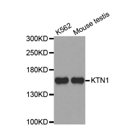 Western blot - KTN1 antibody from Signalway Antibody (38704) - Antibodies.com