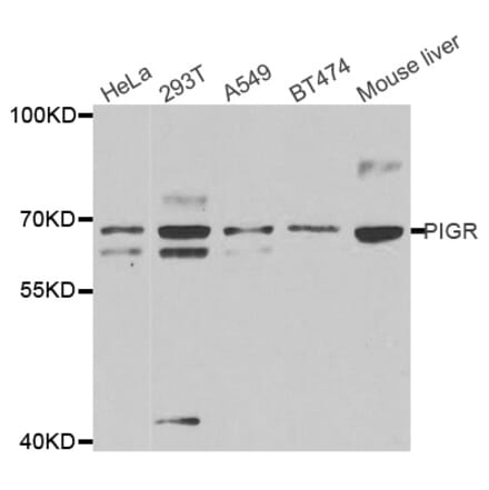 Western blot - PIGR antibody from Signalway Antibody (38723) - Antibodies.com