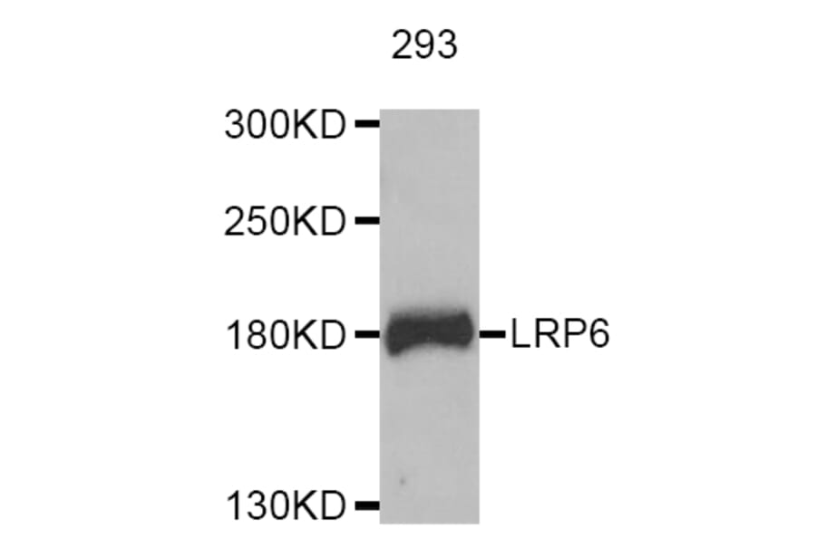 Western blot - LRP6 antibody from Signalway Antibody (38724) - Antibodies.com