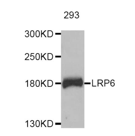 Western blot - LRP6 antibody from Signalway Antibody (38724) - Antibodies.com