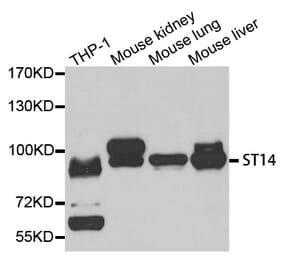 Western blot - ST14 antibody from Signalway Antibody (38725) - Antibodies.com