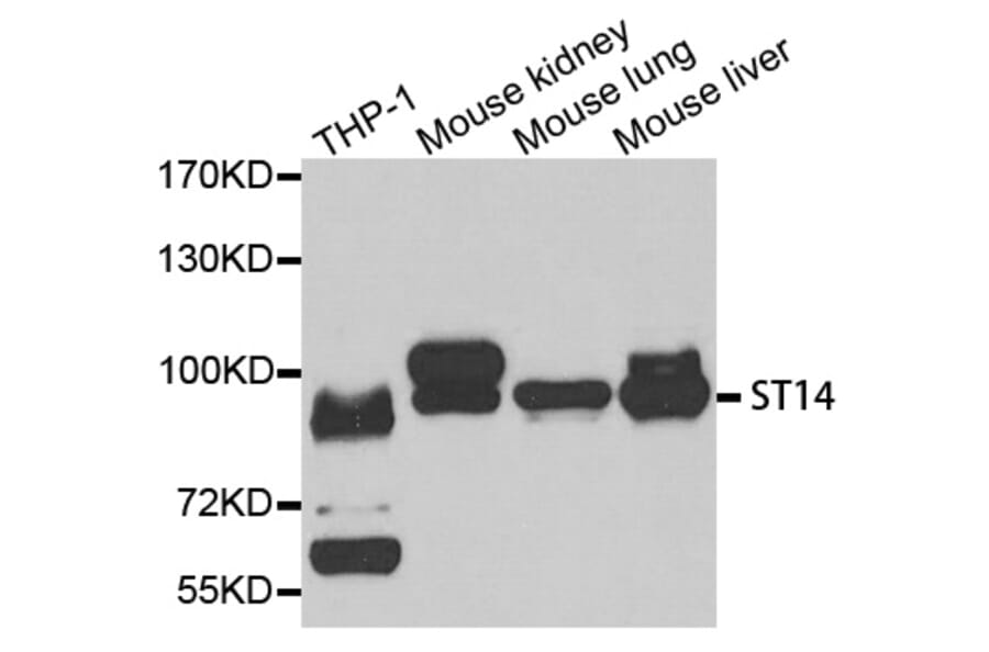 Western blot - ST14 antibody from Signalway Antibody (38725) - Antibodies.com