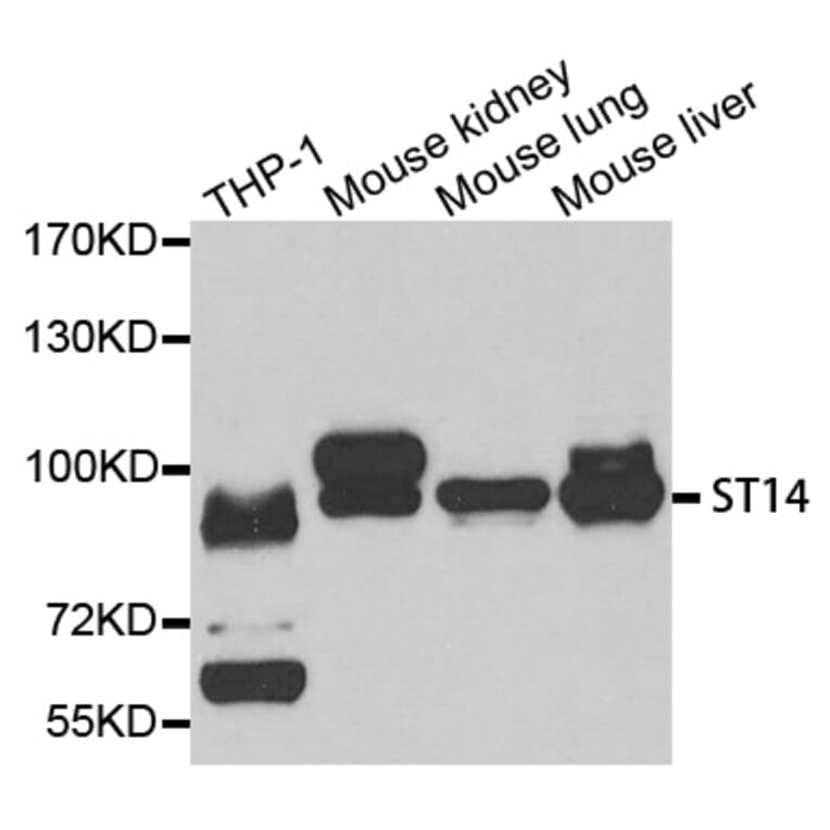 Western blot - ST14 antibody from Signalway Antibody (38725) - Antibodies.com
