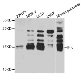 Western blot - IFI6 antibody from Signalway Antibody (38739) - Antibodies.com