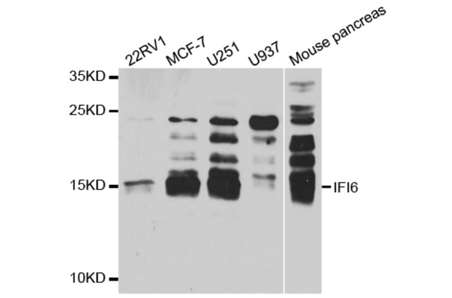 Western blot - IFI6 antibody from Signalway Antibody (38739) - Antibodies.com