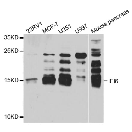 Western blot - IFI6 antibody from Signalway Antibody (38739) - Antibodies.com