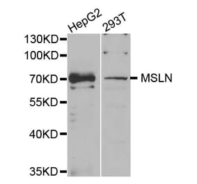 Western blot - MSLN antibody from Signalway Antibody (38740) - Antibodies.com