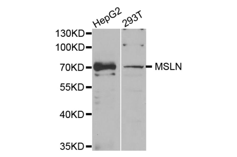 Western blot - MSLN antibody from Signalway Antibody (38740) - Antibodies.com