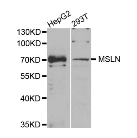 Western blot - MSLN antibody from Signalway Antibody (38740) - Antibodies.com