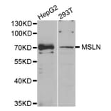 Western blot - MSLN antibody from Signalway Antibody (38740) - Antibodies.com