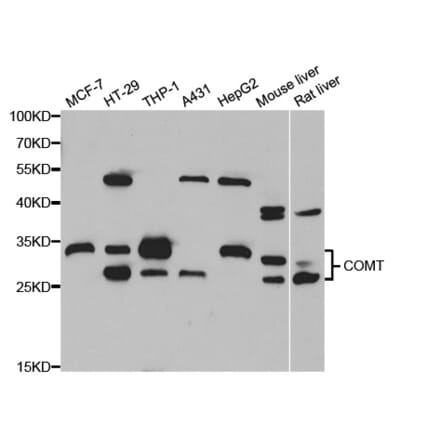Western blot - COMT antibody from Signalway Antibody (38744) - Antibodies.com
