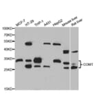 Western blot - COMT antibody from Signalway Antibody (38744) - Antibodies.com