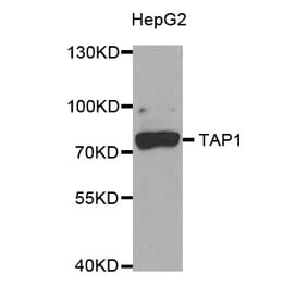 Western blot - TAP1 antibody from Signalway Antibody (38753) - Antibodies.com