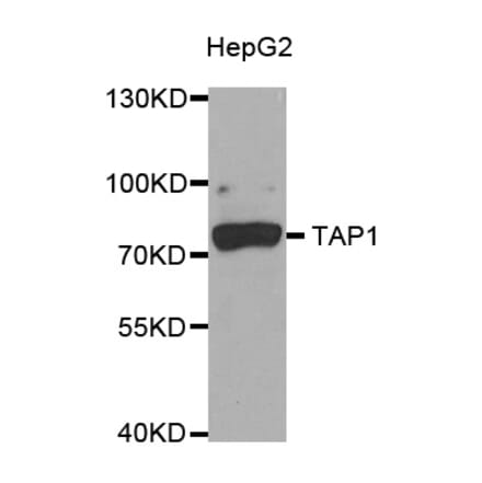 Western blot - TAP1 antibody from Signalway Antibody (38753) - Antibodies.com