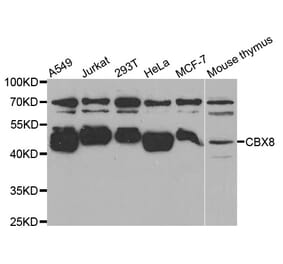 Western blot - CBX8 antibody from Signalway Antibody (38758) - Antibodies.com