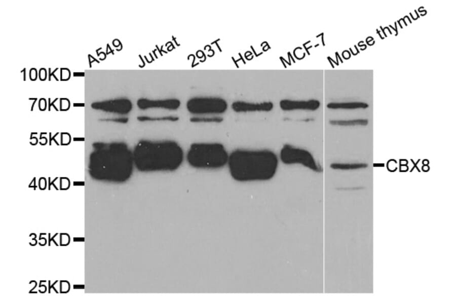 Western blot - CBX8 antibody from Signalway Antibody (38758) - Antibodies.com
