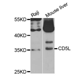 Western blot - CD5L antibody from Signalway Antibody (38759) - Antibodies.com