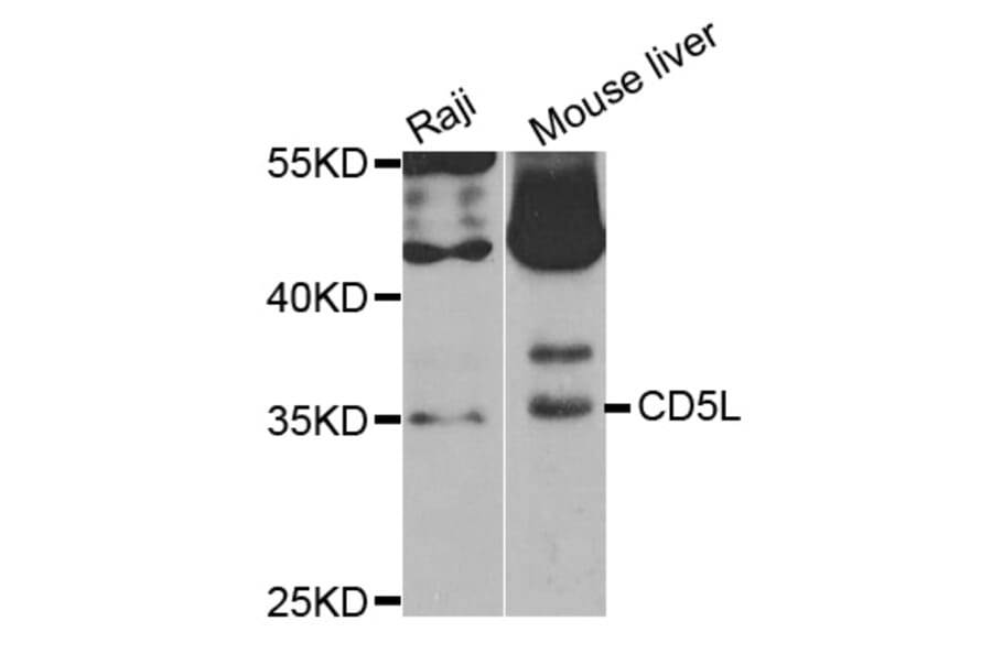 Western blot - CD5L antibody from Signalway Antibody (38759) - Antibodies.com