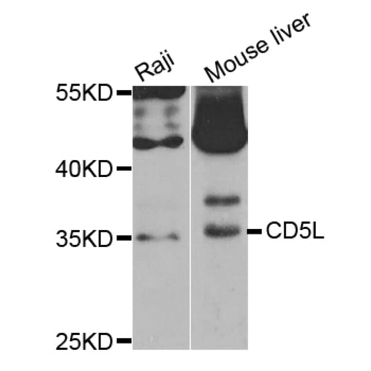 Western blot - CD5L antibody from Signalway Antibody (38759) - Antibodies.com