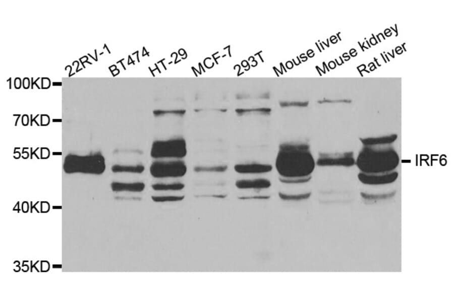 Western blot - IRF6 antibody from Signalway Antibody (38773) - Antibodies.com