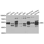 Western blot - IRF6 antibody from Signalway Antibody (38773) - Antibodies.com