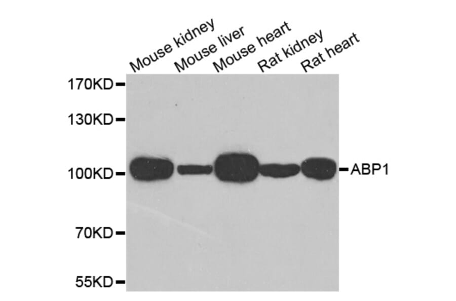 Western blot - AOC1 antibody from Signalway Antibody (38775) - Antibodies.com