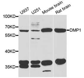 Western blot - DMP1 antibody from Signalway Antibody (38779) - Antibodies.com