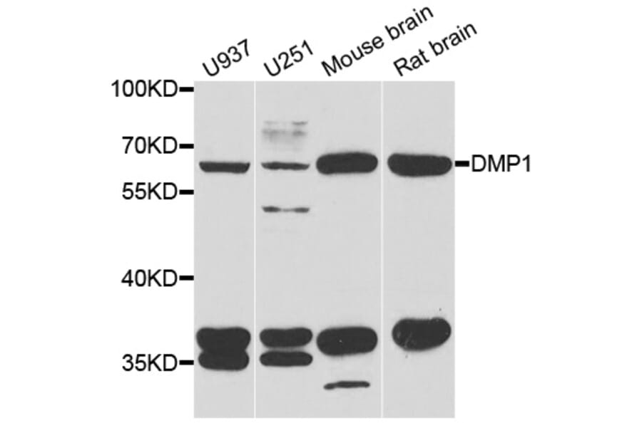Western blot - DMP1 antibody from Signalway Antibody (38779) - Antibodies.com