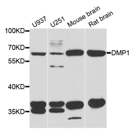 Western blot - DMP1 antibody from Signalway Antibody (38779) - Antibodies.com