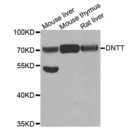 Western blot - DNTT antibody from Signalway Antibody (38780) - Antibodies.com