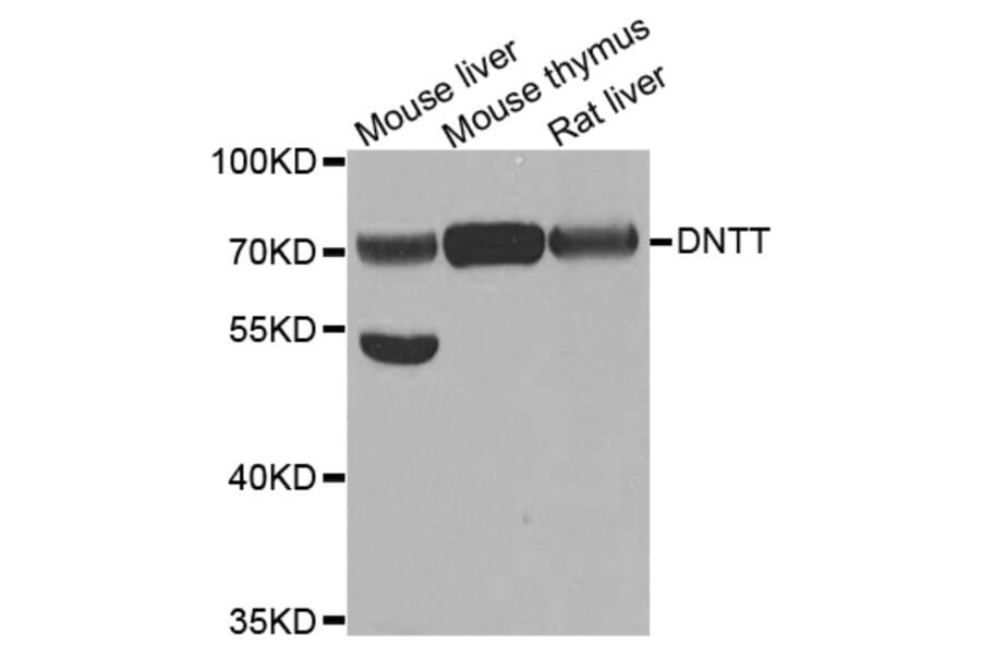 Western blot - DNTT antibody from Signalway Antibody (38780) - Antibodies.com