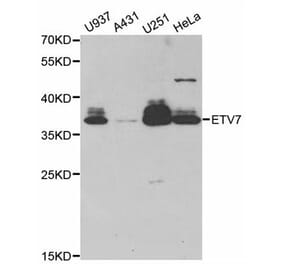 Western blot - ETV7 antibody from Signalway Antibody (38781) - Antibodies.com