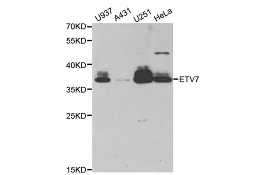 Western blot - ETV7 antibody from Signalway Antibody (38781) - Antibodies.com